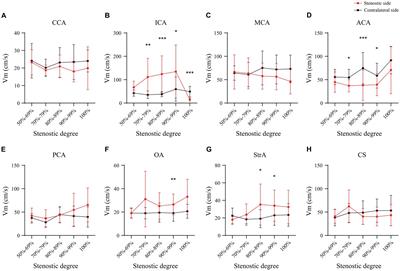 Internal carotid artery stenosis: hemodynamics in the ipsilateral ACA affects CT angiography manifestations